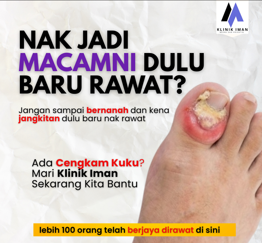 CONVERSION P4 1 E1771903974427