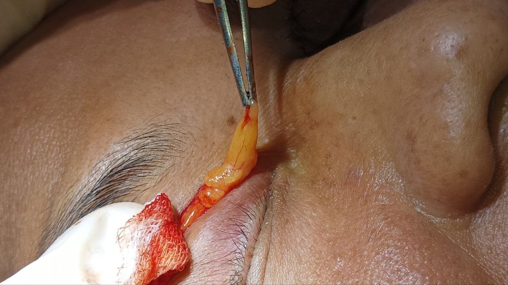 Photo 6253586376163003721 Y 1 1024x574