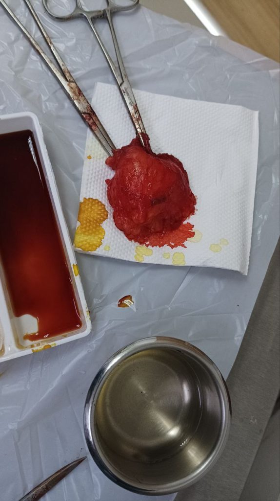 Photo 6321088946930126726 Y 1 574x1024