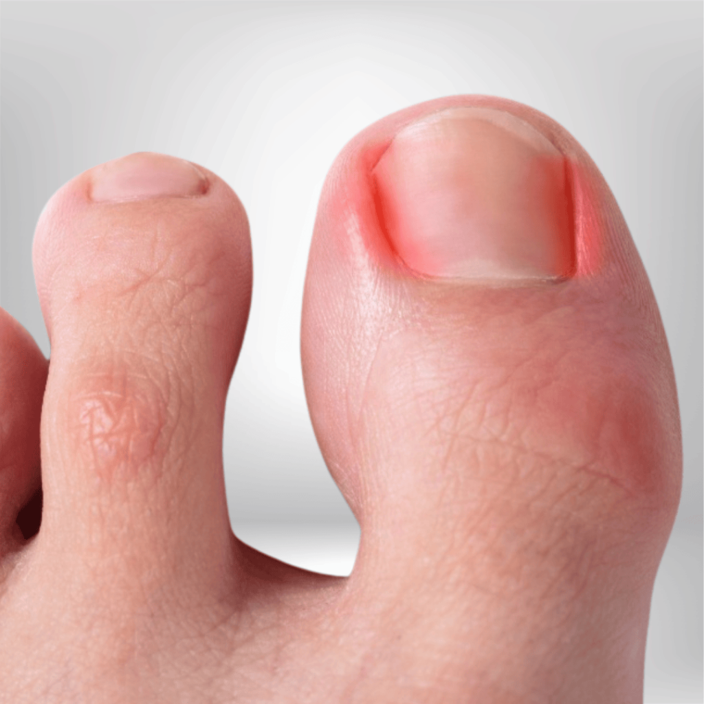 consideration p2 (12) consideration p2 (12)